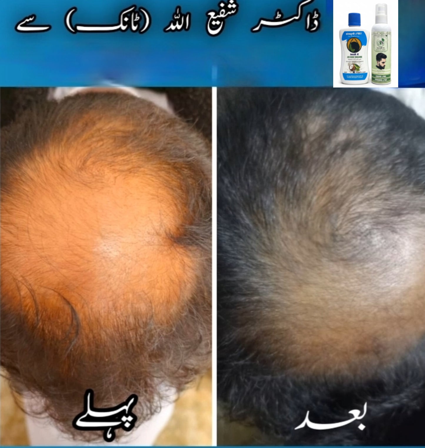 Dr Masood Organic Hair Oil & Spray Combo